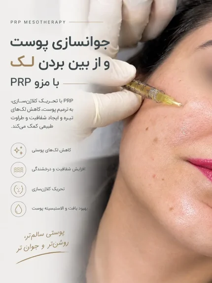 جوانسازی و بهبود کیفیت پوست با مزو PRP
