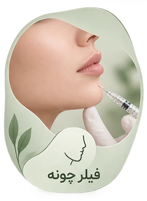Chin filler